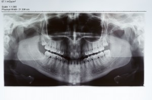 x ray